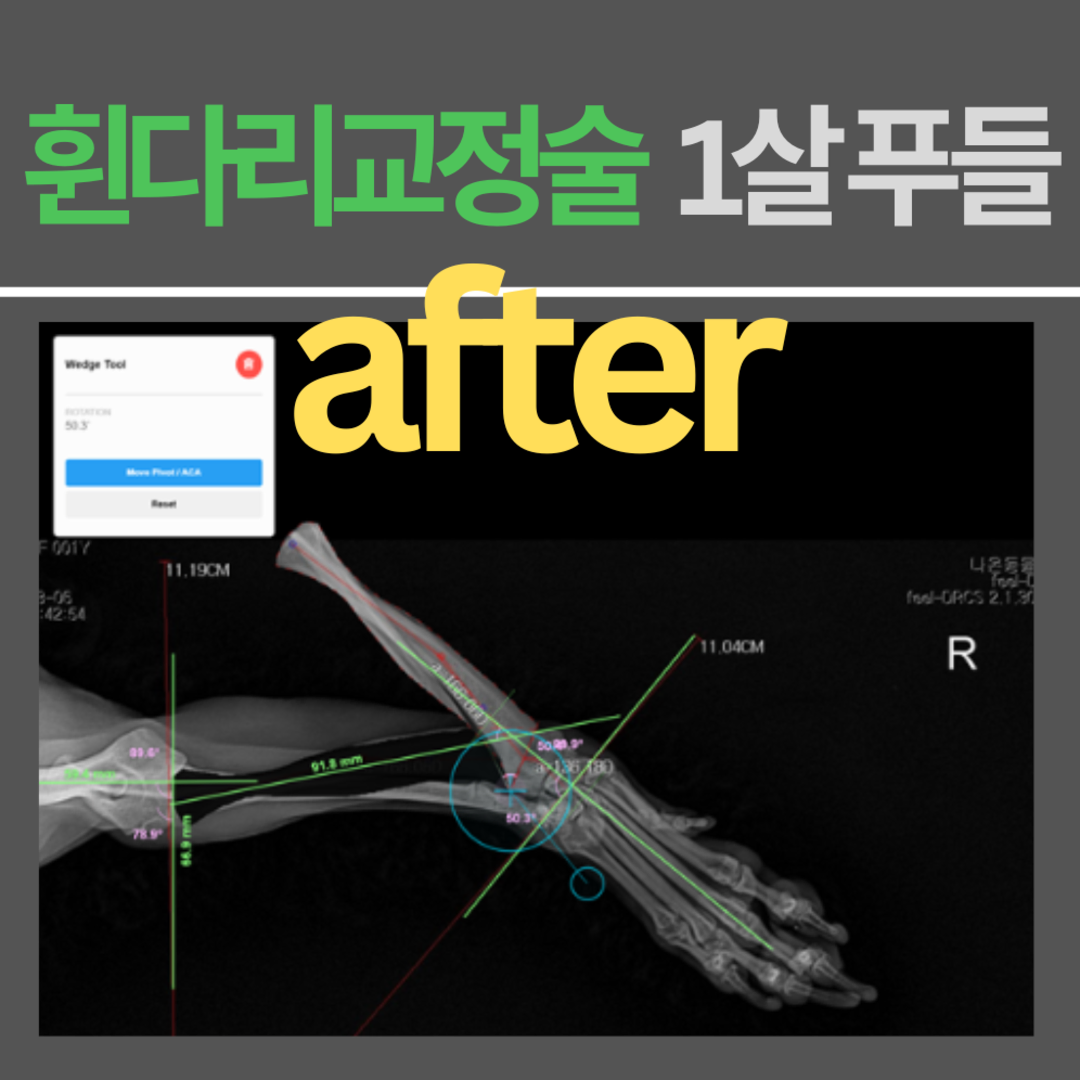 사진 7