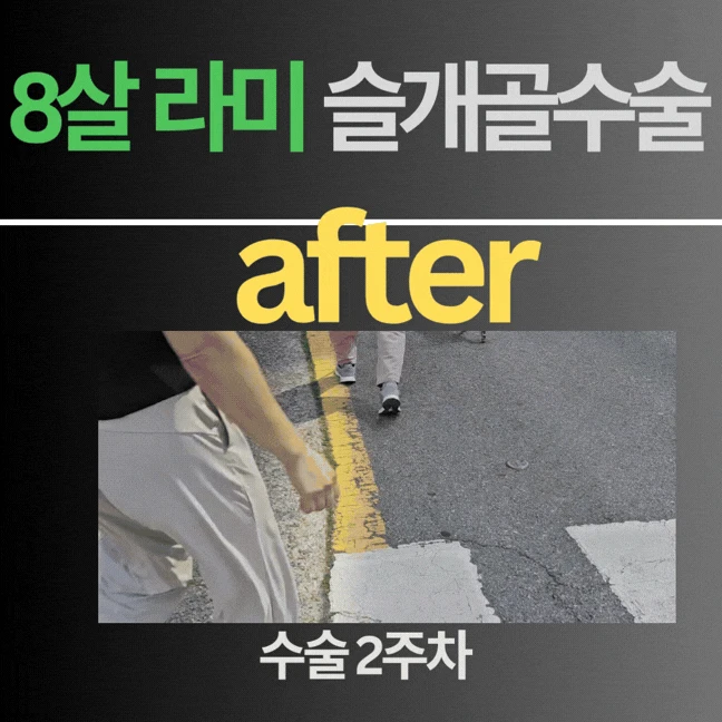 움짤 2