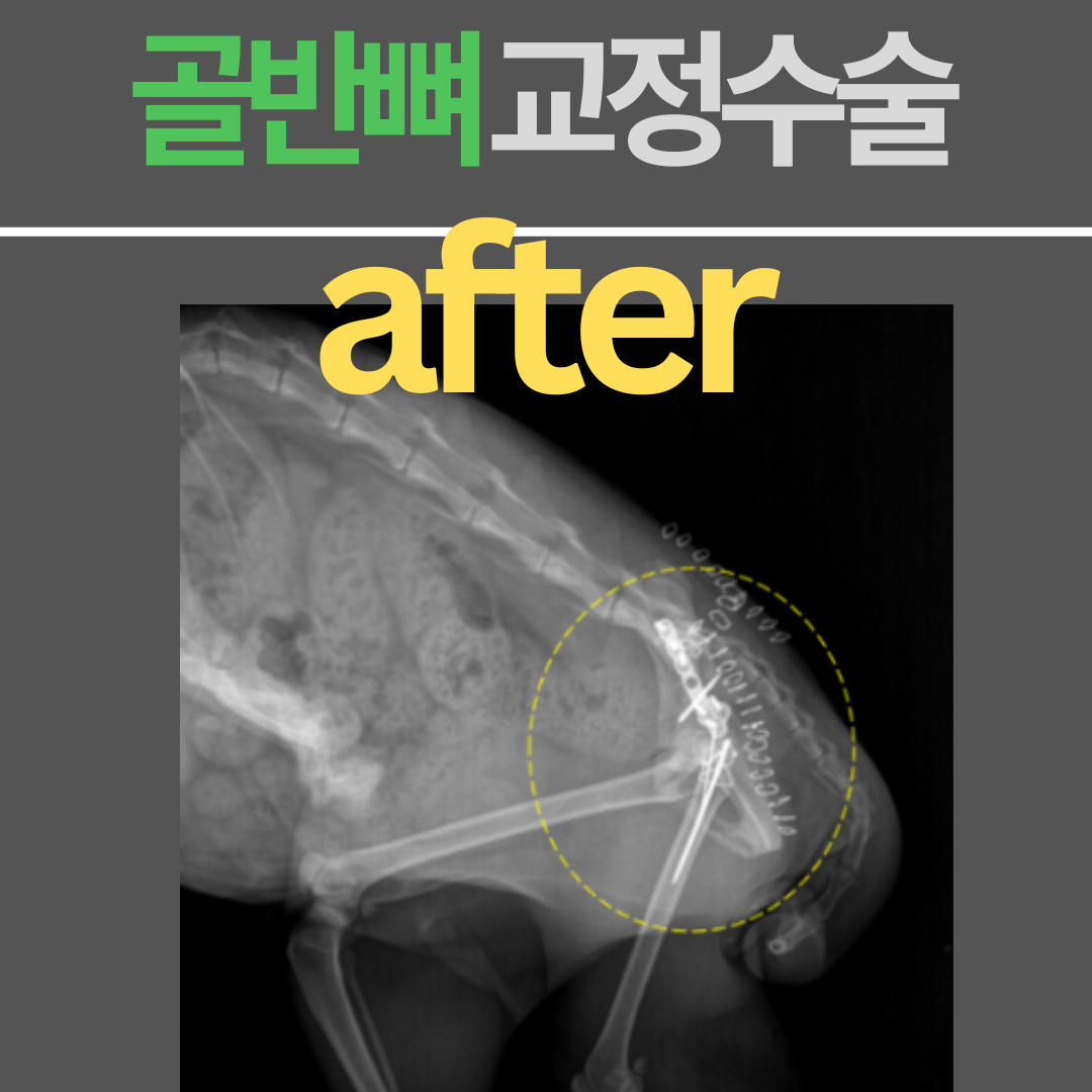 사진 1