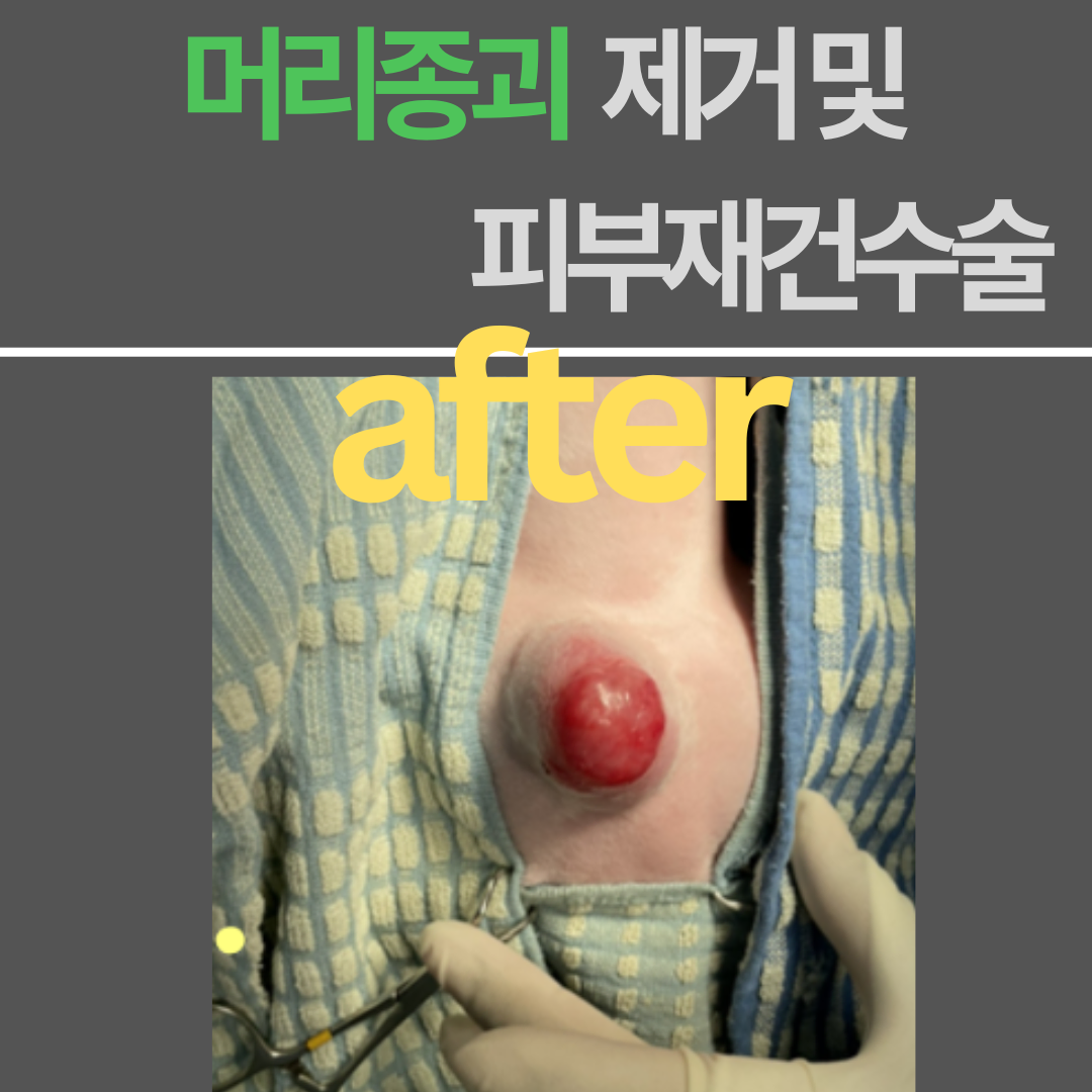 사진 4